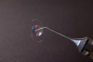 clear lens exchange