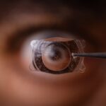 Intraocular Lens Implants