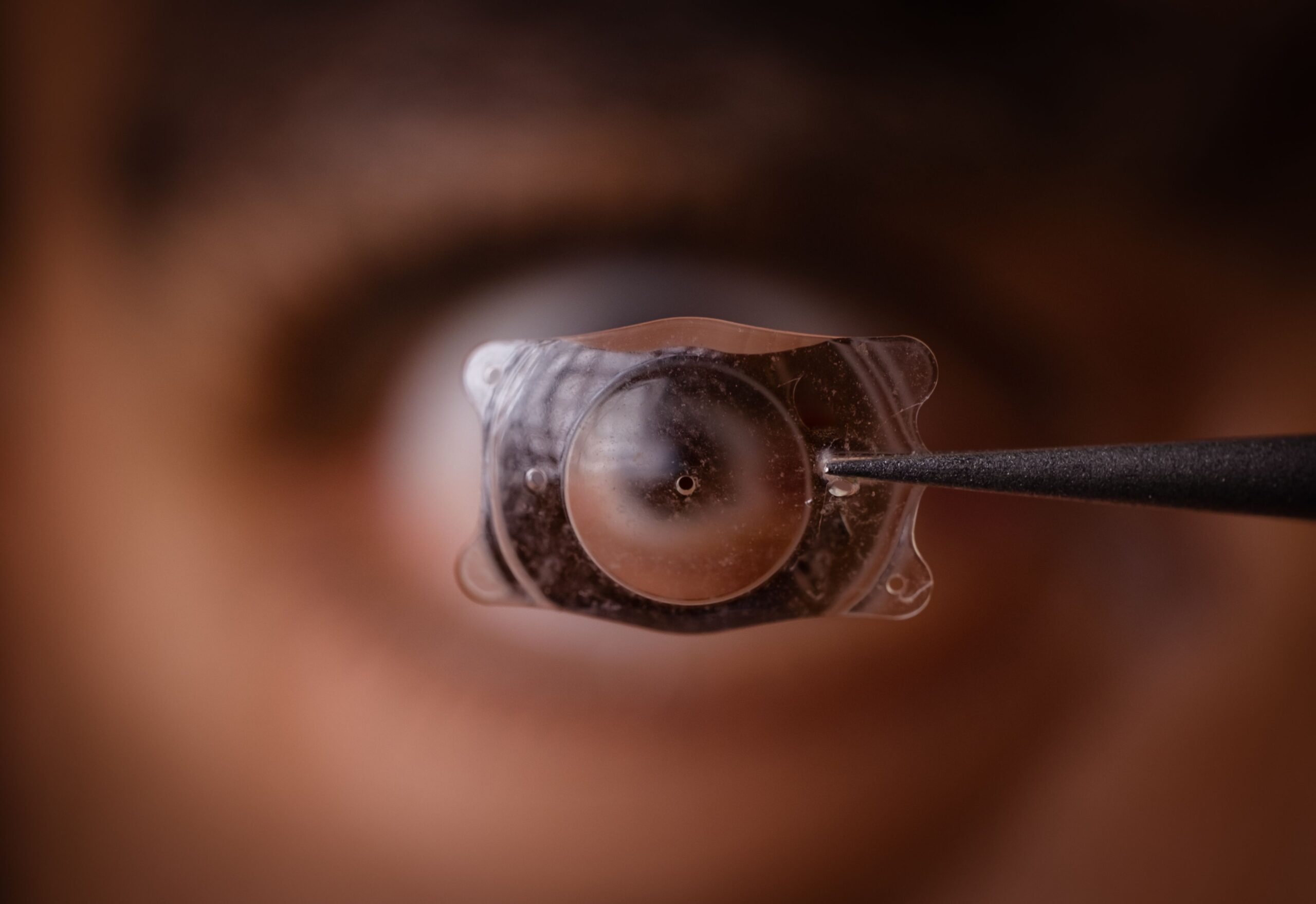 Intraocular Lens Implants