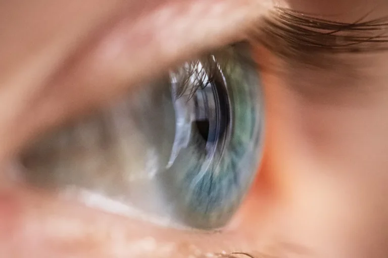 Who Is a Good Candidate for Refractive Lens Exchange