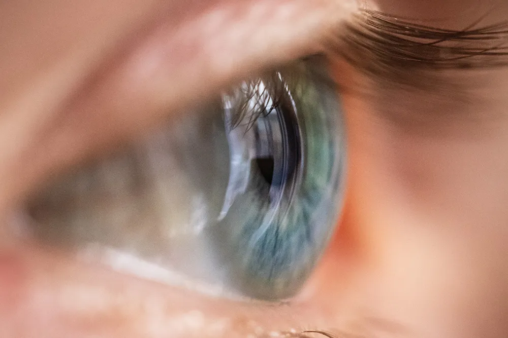 Who Is a Good Candidate for Refractive Lens Exchange