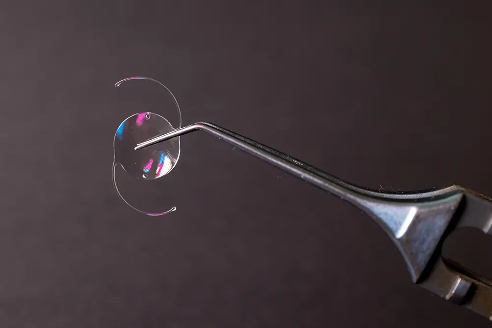 Complete Guide for Patients for Intraocular Lenses