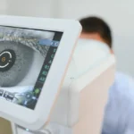 What Do Cataracts Look Like